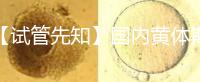 【試管先知】國內(nèi)黃體期方案經(jīng)驗(yàn)緊缺,2點(diǎn)促排弊端需了解