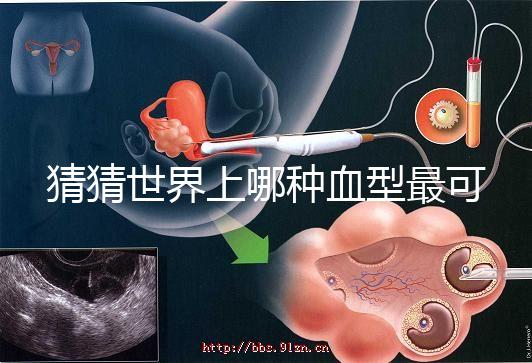 猜猜世界上哪種血型最可怕，史上超全排行榜為你揭曉答案