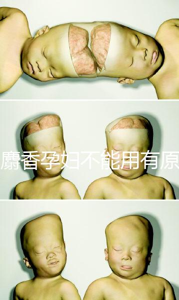 白麝香孕婦不能用有原因，流產、早產…這些危害不得不知