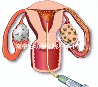 南京婦幼保健院不孕不育醫生排名匯總,掛哪個好一目了然