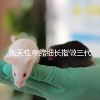 先天性攣縮細長指做三代試管嬰兒能避免遺傳嗎