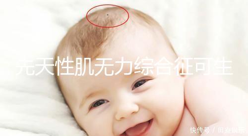 先天性肌無力綜合征可生育嗎？能做試管避免遺傳？