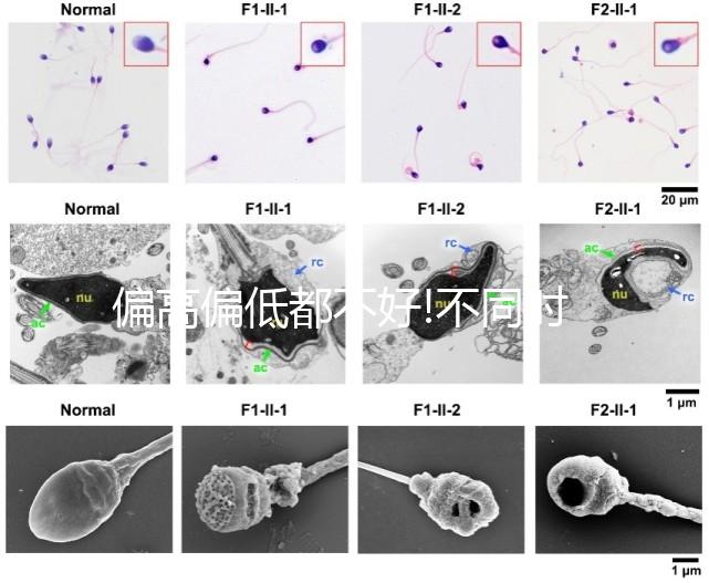 偏高偏低都不好!不同時(shí)期促卵泡成熟激素正常值一覽