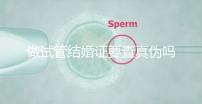 做試管結(jié)婚證要查真?zhèn)螁幔ㄗ鲈嚬芙Y(jié)婚證要查真?zhèn)螁岫嗌馘X)