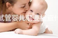 做試管嬰兒前要檢查什么(做試管嬰兒前要檢查什么項(xiàng)目)