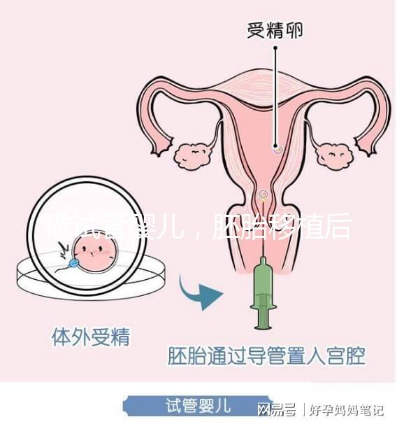 做試管嬰兒，胚胎移植后需要住院嗎？