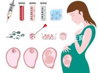 辦準(zhǔn)生證沒(méi)必要隱瞞生育史,女方再婚需帶離婚證