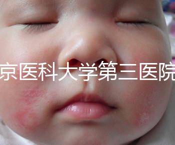 北京醫科大學第三醫院nt檢查費用盤點需要多長時間，是否預約