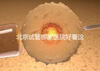 北京試管哪家醫(yī)院好看這,303醫(yī)院、北醫(yī)三院值得推薦