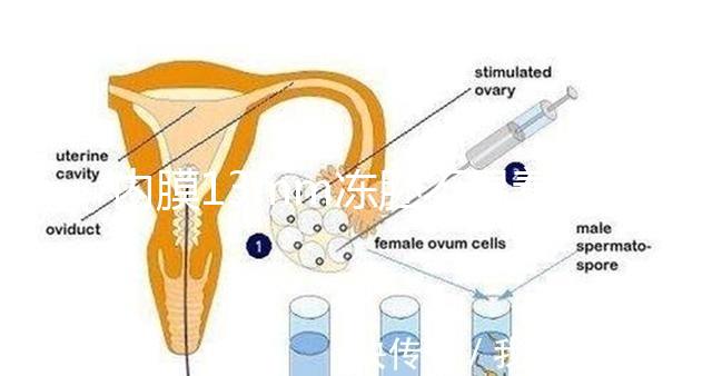 內(nèi)膜13mm凍胚不易著床要注意,移植與否看醫(yī)生怎么說