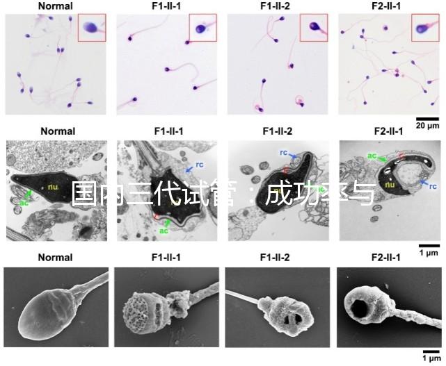 國(guó)內(nèi)三代試管:成功率與費(fèi)用全知曉?