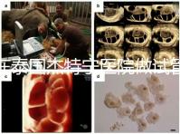 在泰國杰特寧醫院做試管嬰兒的費用明細和醫院排名清單,輕松規劃你的試管旅程!