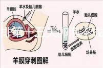 促排第十五天卵泡不成熟還可以治療!1.2等幾天就能長大