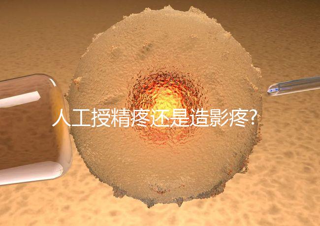 人工授精疼還是造影疼?被瞎對比，二者疼痛不是一個等級