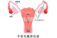 產(chǎn)后喝生化湯排惡露會(huì)使寶寶拉肚子?醫(yī)生:時(shí)間沒(méi)用對(duì)