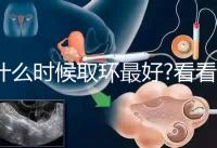 什么時候取環(huán)最好?看看各地姐妹們有什么經(jīng)驗(yàn)之談