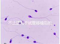 不止適用于試管移植后的胚胎著床,美卓樂的8大作用盤點(diǎn)