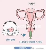 一篇告訴你結(jié)婚三金要花多少錢(qián)，高不高還得看克數(shù)