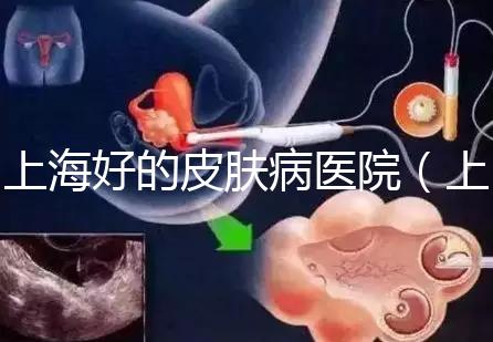 上海好的皮膚病醫(yī)院（上海皮膚科排名第一）