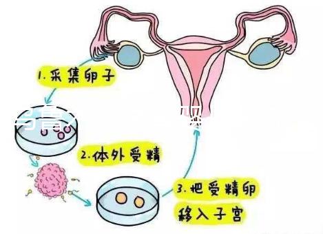 烏魯木齊試管嬰兒醫(yī)院排名最好(新疆試管成功率最高的醫(yī)院)