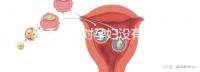 乳香氣味對孕婦沒有影響?致畸、導致流產不能忽視