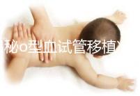 揭秘o型血試管移植凍囊胚費(fèi)用,解凍+手術(shù)操作至少這個數(shù)