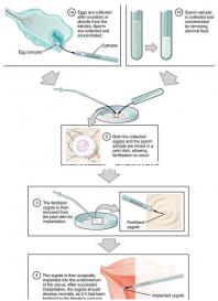 成都華西二院無創(chuàng)dna價格來了,2024想造哪里能免費做看這