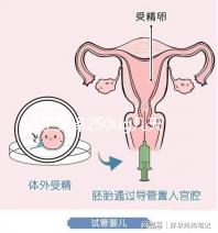 打了艾澤250ug幾天能代謝完戳,第十天別還不敢走下一步