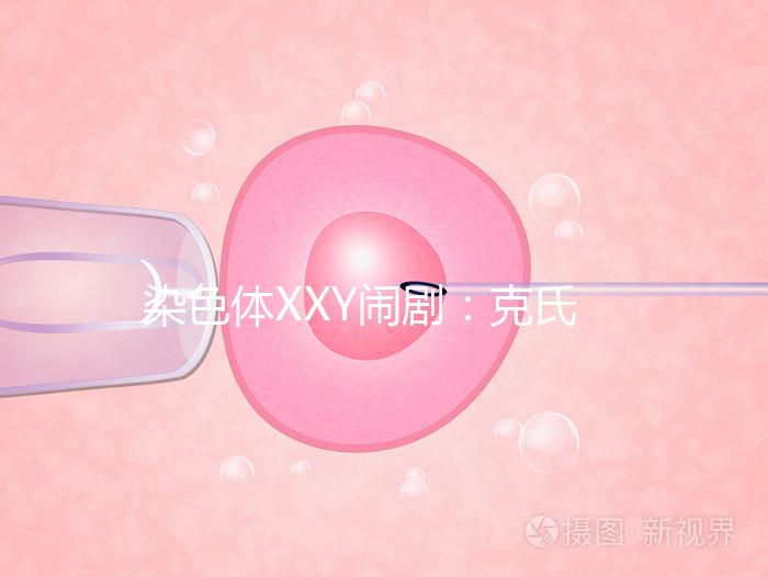 染色體XXY鬧?。嚎耸暇C合征，帶你走進“第三性別”群體