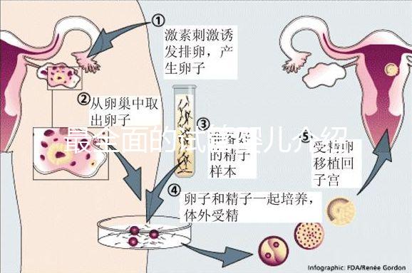 最全面的試管嬰兒介紹