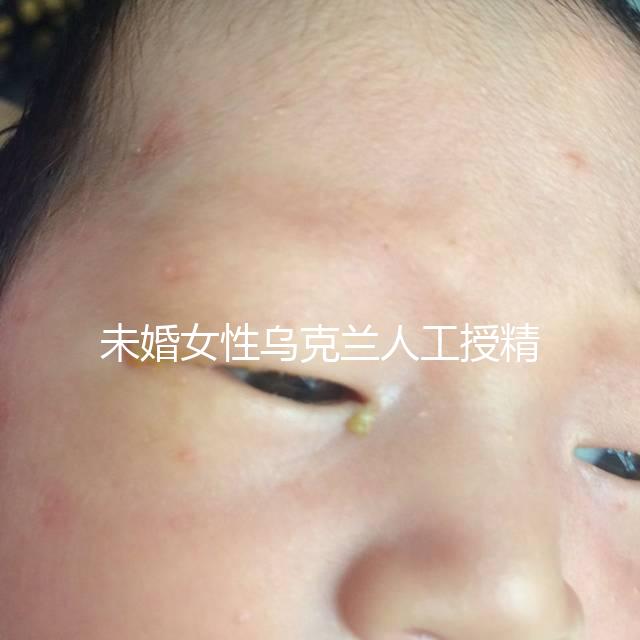 未婚女性烏克蘭人工授精必看！醫療及生活費用明細預覽