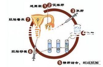 文昌哪里能做試管嬰兒?國(guó)內(nèi)做一次成功率有多高?