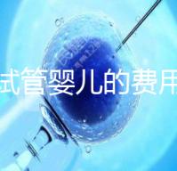日本試管嬰兒的費用是多少？附加在其他國家的價格差異