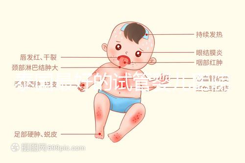 泰國最好的試管嬰兒醫院(泰國最好的試管嬰兒醫院是哪個)