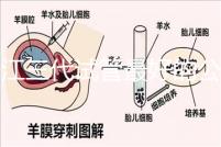 浙江三代試管最好的公立醫院推薦，參考性大隨你挑