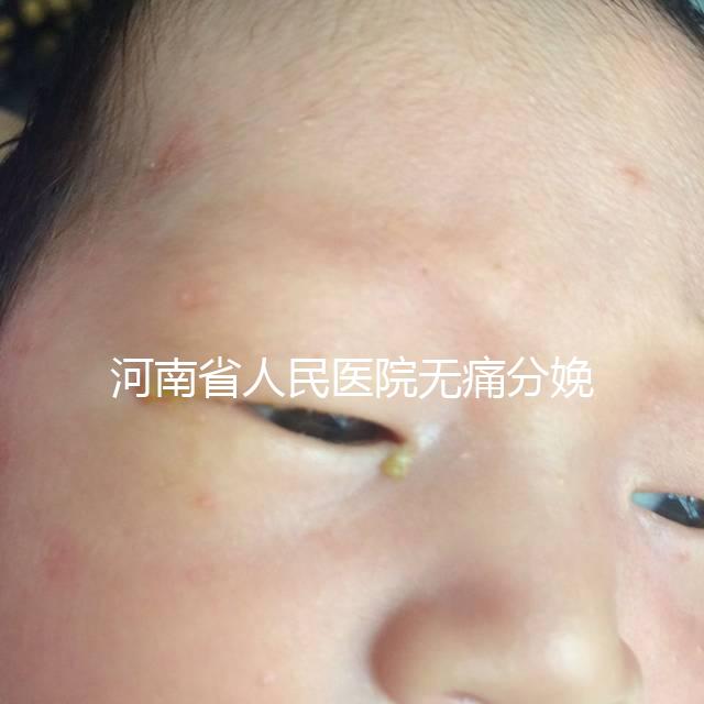 河南省人民醫院無痛分娩多少錢戳，收費標準60s看懂不踩坑