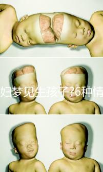 孕婦夢見生孩子?6種情形下的寓意各不同