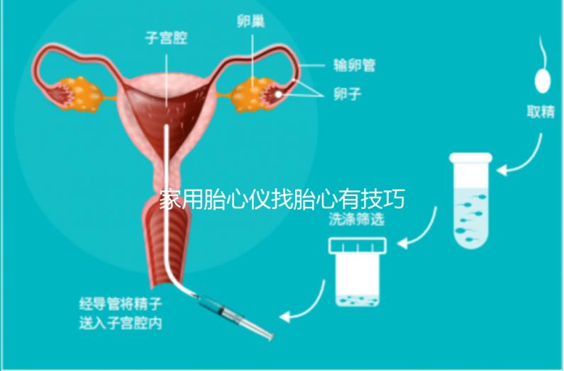 家用胎心儀找胎心有技巧,飯后半個(gè)小時(shí)測準(zhǔn)確率稍高