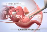 備孕小知識(shí)：月經(jīng)不調(diào)吃黃體酮或補(bǔ)佳樂(lè)還是達(dá)英35好