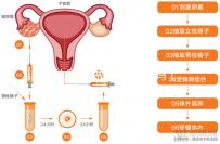 女扎后能做試管嬰兒?jiǎn)幔?5歲結(jié)扎了還能做試管嬰兒?jiǎn)幔? /></div><sup date-time=