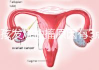 小孩發(fā)燒抽搐原因有3點，急救很關鍵！