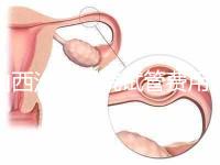 山西汾陽醫(yī)院試管費(fèi)用清單公布，2024年生殖科助孕成功率公布