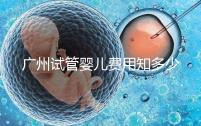 廣州試管嬰兒費用知多少?2025年廣州試管全過程費用與流程清單