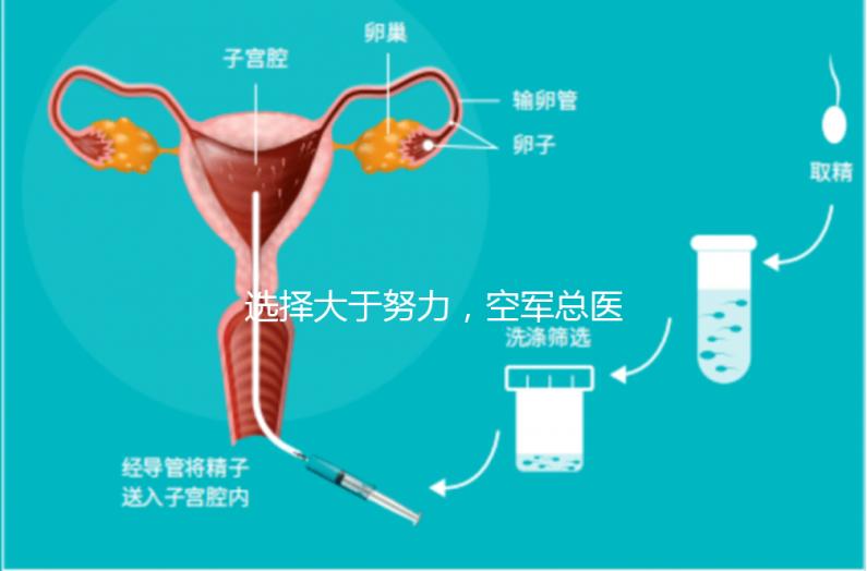 選擇大于努力，空軍總醫(yī)院做試管嬰兒必讀攻略