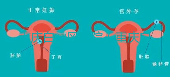 重慶白癜風醫院（重慶白癜風?？漆t院在哪里）