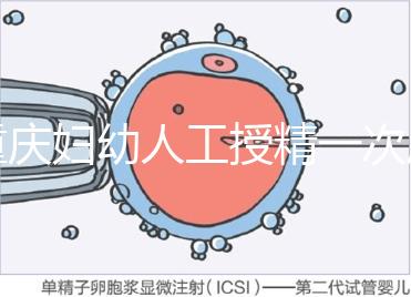 重慶婦幼人工授精一次成功率揭秘，移植費(fèi)用貴有原因