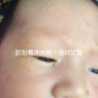 胚胎著床失??？選對試管嬰兒醫生很重要