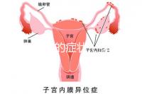 脾胃濕熱的癥狀(脾胃濕熱的癥狀有哪些)