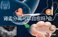 腎盂分離可以自愈嗎?會不會自己好要看造成的病因