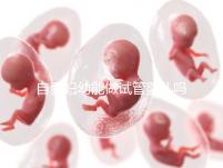自貢婦幼能做試管嬰兒?jiǎn)幔克拇ㄊ?nèi)這些生殖中心才可以